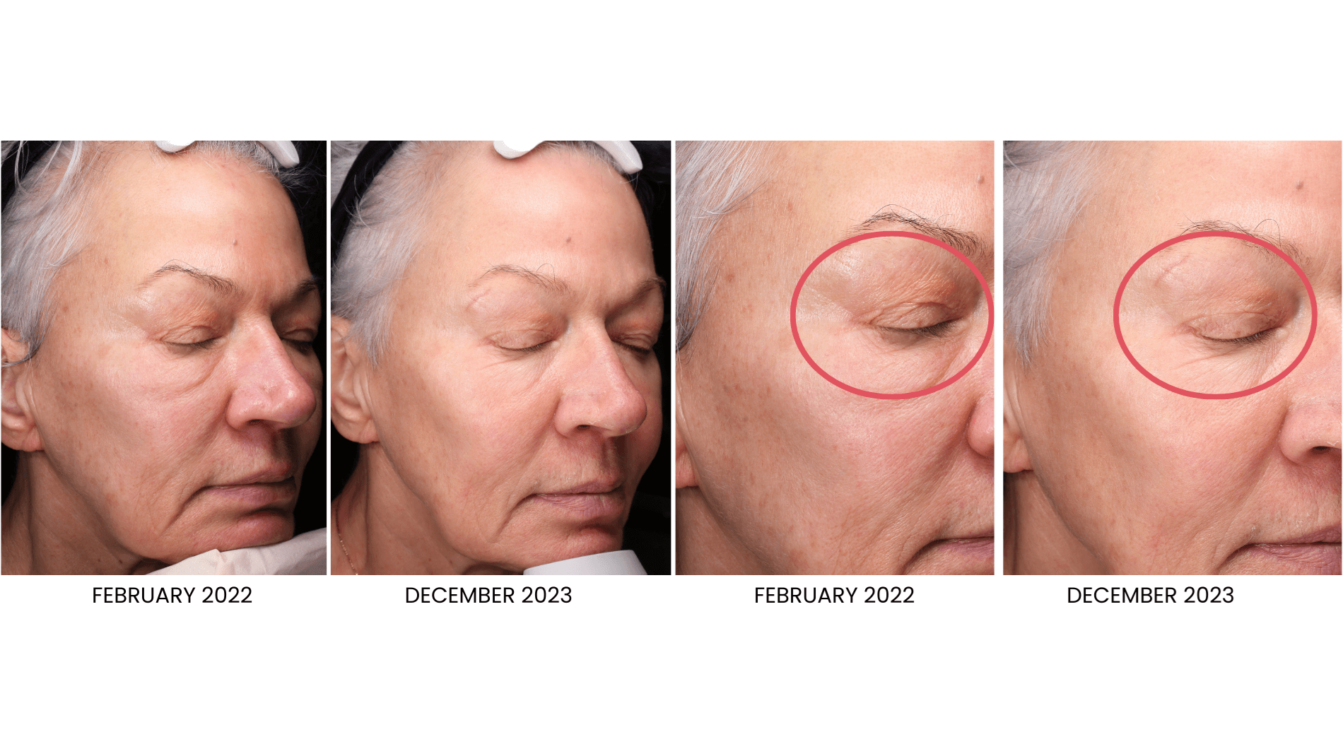 Results from morpheus